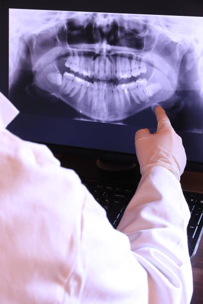 Best Emergency Wisdom Teeth Removal in Luling, LA